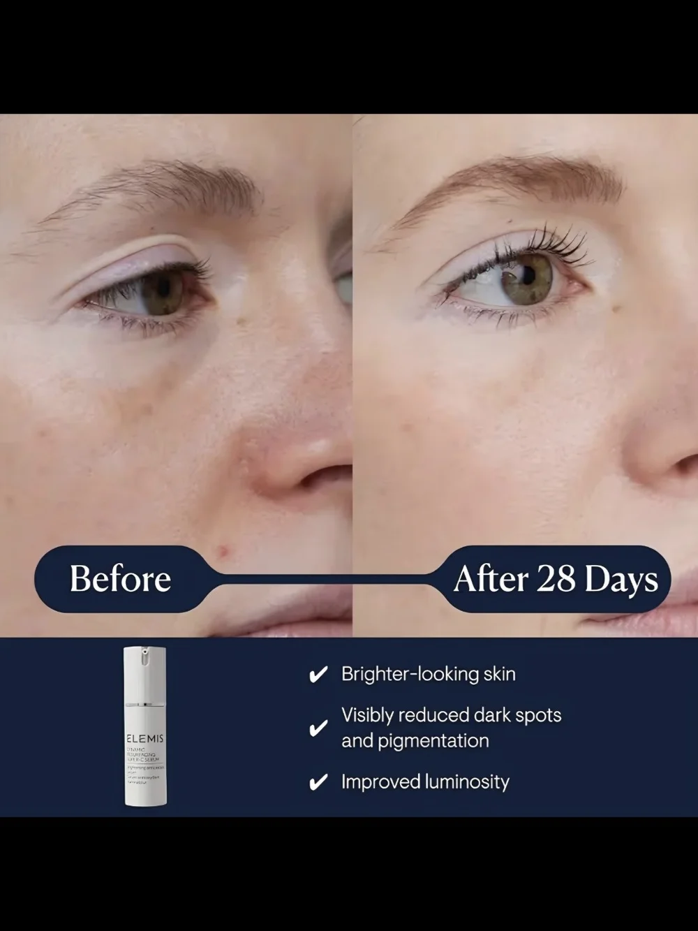 ELEMIS White Dynamic Resurfacing Super-C Serum